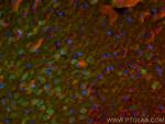 PCP4 Antibody in Immunohistochemistry (PFA fixed) (IHC (PFA))