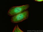 MGEA5 Antibody in Immunocytochemistry (ICC/IF)