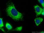 ERp72 Antibody in Immunocytochemistry (ICC/IF)