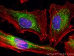 PDHB Antibody in Immunocytochemistry (ICC/IF)