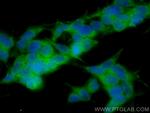 CORO1C Antibody in Immunocytochemistry (ICC/IF)