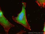 CRIP2 Antibody in Immunocytochemistry (ICC/IF)
