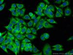 GIPC1 Antibody in Immunocytochemistry (ICC/IF)