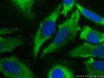 RPS27A Antibody in Immunocytochemistry (ICC/IF)