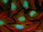 SNIP1 Antibody in Immunocytochemistry (ICC/IF)
