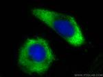 PABPC4 Antibody in Immunocytochemistry (ICC/IF)