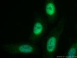 SKP2 Antibody in Immunocytochemistry (ICC/IF)