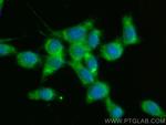 HAI-1 Antibody in Immunocytochemistry (ICC/IF)