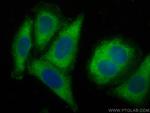 AZI2/NAP1 Antibody in Immunocytochemistry (ICC/IF)