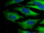 ARPC2 Antibody in Immunocytochemistry (ICC/IF)