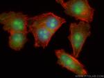 EXOSC3 Antibody in Immunocytochemistry (ICC/IF)