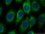 LPCAT2 Antibody in Immunocytochemistry (ICC/IF)