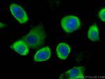 GSTO1 Antibody in Immunocytochemistry (ICC/IF)