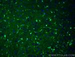 S100 Beta Antibody in Immunohistochemistry (PFA fixed) (IHC (PFA))