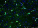 S100 Beta Antibody in Immunohistochemistry (PFA fixed) (IHC (PFA))