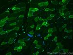 CA3 Antibody in Immunohistochemistry (PFA fixed) (IHC (PFA))