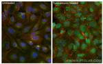 CHOP/GADD153 Antibody in Immunocytochemistry (ICC/IF)