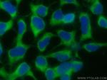 CRACR2A Antibody in Immunocytochemistry (ICC/IF)