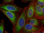 VAPA Antibody in Immunocytochemistry (ICC/IF)