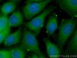 MYL9 Antibody in Immunocytochemistry (ICC/IF)