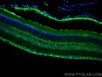 RLBP1 Antibody in Immunohistochemistry (PFA fixed) (IHC (PFA))