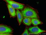 OSBPL10 Antibody in Immunocytochemistry (ICC/IF)