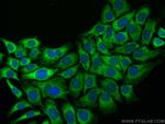 Transgelin-2 Antibody in Immunocytochemistry (ICC/IF)
