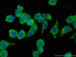 PAFAH Antibody in Immunocytochemistry (ICC/IF)