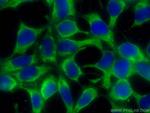 ALDH3A1 Antibody in Immunocytochemistry (ICC/IF)