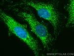 HSDL2 Antibody in Immunocytochemistry (ICC/IF)