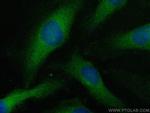 TRIM14 Antibody in Immunocytochemistry (ICC/IF)