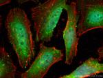 TRBP Antibody in Immunocytochemistry (ICC/IF)