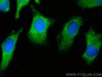 NQO2 Antibody in Immunocytochemistry (ICC/IF)
