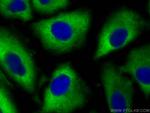 ALDH1A1 Antibody in Immunocytochemistry (ICC/IF)