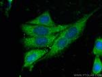 CNOT10 Antibody in Immunocytochemistry (ICC/IF)
