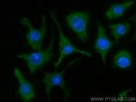 TIPE2 Antibody in Immunocytochemistry (ICC/IF)