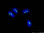 FBL Antibody in Immunocytochemistry (ICC/IF)