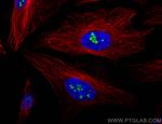 FBL Antibody in Immunocytochemistry (ICC/IF)