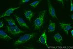 LETM1 Antibody in Immunocytochemistry (ICC/IF)