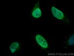 Histone H4 Antibody in Immunocytochemistry (ICC/IF)