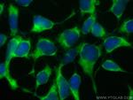 ATP6V1G1 Antibody in Immunocytochemistry (ICC/IF)