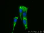 Osteocalcin Antibody in Immunocytochemistry (ICC/IF)