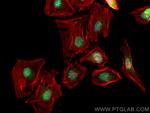 TOE1 Antibody in Immunocytochemistry (ICC/IF)