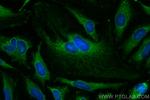 ACAT1 Antibody in Immunocytochemistry (ICC/IF)