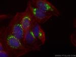 SYAP1 Antibody in Immunocytochemistry (ICC/IF)