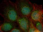 DHRS1 Antibody in Immunocytochemistry (ICC/IF)