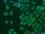 CEP70 Antibody in Immunocytochemistry (ICC/IF)