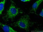 MRPS31 Antibody in Immunocytochemistry (ICC/IF)