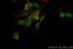 CHMP7 Antibody in Immunocytochemistry (ICC/IF)