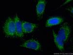 DLD Antibody in Immunocytochemistry (ICC/IF)